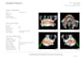 do implant planning and surgical guides